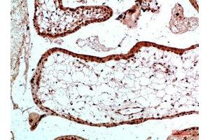 anti-Ubiquitin B (UBB) antibody