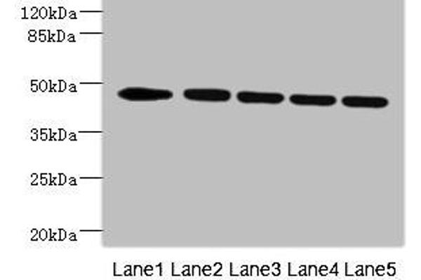 VRK1 antibody  (AA 257-396)