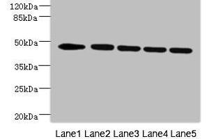 Western blot All lanes: DCXR antibody at 4.