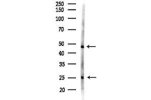 anti-Eosinophil Peroxidase (EPX) antibody