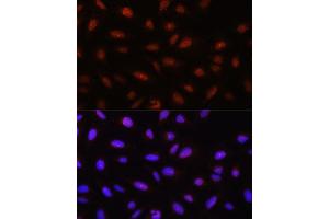 Immunofluorescence analysis of U-2 OS cells using // antibody (ABIN7265520) at dilution of 1:100. (AKT 1/2/3 antibody)