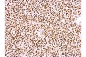 IHC-P Image BCCIP antibody detects BCCIP protein at nucleus on BT483 xenograft by immunohistochemical analysis. (BCCIP antibody  (C-Term))