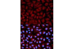 Immunofluorescence analysis of U2OS cell using SERPINC1 antibody. (SERPINC1 antibody  (AA 33-185))