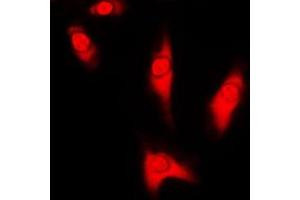 Immunofluorescent analysis of DJ-1 staining in HeLa cells. (PARK7/DJ1 antibody  (Center))
