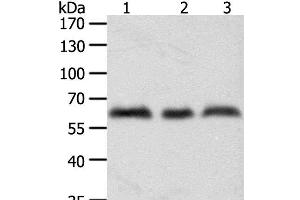 Western Blot analysis of A375, Hela and Jurkat cell using TYR Polyclonal Antibody at dilution of 1:600 (TYR antibody)