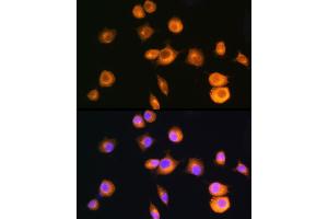 Immunofluorescence analysis of L929 cells using [KO Validated] PKA RIIα (PRKA)/PKR2 Rabbit pAb (ABIN1513416, ABIN3022083, ABIN3022084 and ABIN5663933) at dilution of 1:100 (40x lens). (PRKAR2A antibody  (AA 1-404))