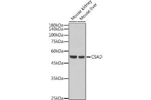 Western blot analysis of extracts of various cell lines, using CSAD antibody (ABIN6133497, ABIN6139087, ABIN6139088 and ABIN6217983) at 1:5000 dilution.