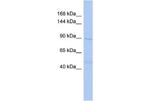 WB Suggested Anti-DNMT3B Antibody Titration:  0. (DNMT3B antibody  (Middle Region))
