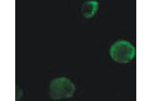 Immunofluorescence staining of Calr in HCT15 colon cancer cells using Calr polyclonal antibody . (Calreticulin antibody)