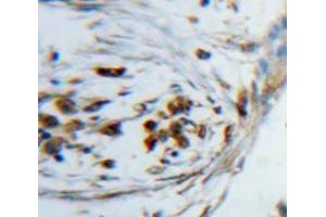 Used in DAB staining on fromalin fixed paraffin-embedded lung tissue (KDM4A antibody  (AA 141-310))