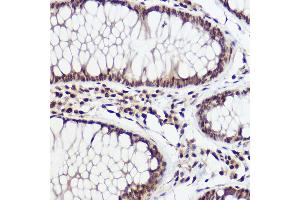 Immunohistochemistry (IHC) image for anti-WW Domain Binding Protein 11 (WBP11) (AA 1-140) antibody (ABIN7271390)