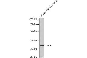 Western blot analysis of extracts of mouse skeletal muscle, using FRZB antibody (ABIN6131654, ABIN6140777, ABIN6140778 and ABIN6222275) at 1:1000 dilution. (FRZB antibody  (AA 166-325))
