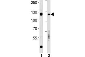 Rb antibody western blot analysis in 1) Daudi and 2) Raji lysate. (Retinoblastoma Protein (Rb) antibody  (AA 586-615))