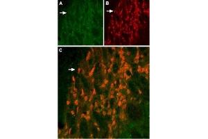 Expression of KV11. (KCNH6 antibody  (Intracellular))