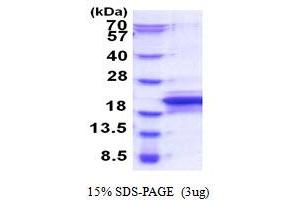 SDS-PAGE (SDS) image for Motile Sperm Domain Containing 1 (MOSPD1) (AA 1-158) protein (His tag) (ABIN5853938)