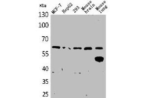 Western Blot analysis of MCF7 HepG2 293 mouse brain mouse lung cells using ZKSCAN4 Polyclonal Antibody (ZKSCAN4 antibody  (Internal Region))