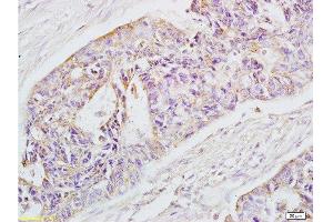 Immunohistochemistry (Paraffin-embedded Sections) (IHC (p)) image for anti-Epithelial Cell Adhesion Molecule (EPCAM) (AA 221-314) antibody (ABIN687592)
