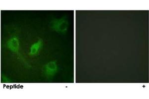 Immunofluorescence analysis of HeLa cells, using NFKBIE polyclonal antibody .