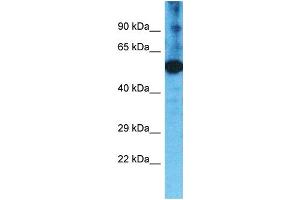 Western Blotting (WB) image for anti-Transmembrane Protease, Serine 11F (TMPRSS11F) (C-Term) antibody (ABIN2791959) (TMPRSS11F antibody  (C-Term))