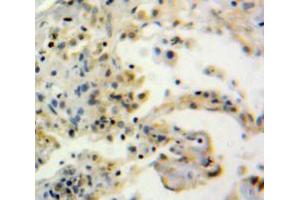 Used in DAB staining on fromalin fixed paraffin-embedded Lung tissue (Thimet Oligopeptidase 1 antibody  (AA 451-597))