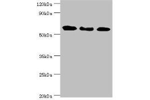 Western blot All lanes: Interferon-induced guanylate-binding protein 1 antibody at 4 μg/mL Lane 1: MM231 whole cell lysate Lane 2: Hela whole cell lysate Lane 3: MGF-7 whole cell lysate Secondary Goat polyclonal to rabbit IgG at 1/10000 dilution Predicted band size: 68 kDa Observed band size: 68 kDa
