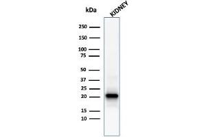 Western Blot Analysis of human kidney tissue lysate using Ferritin, Light Chain Mouse Monoclonal Antibody (FTL/1386). (FTL antibody  (AA 38-165))