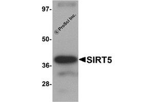 Western Blotting (WB) image for anti-Sirtuin 5 (SIRT5) (C-Term) antibody (ABIN1030665)