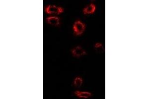 Immunofluorescent analysis of Syntenin staining in SW480 cells. (SDCBP antibody)