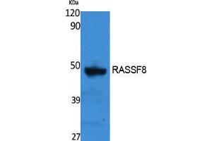 Western Blotting (WB) image for anti-Ras Association (RalGDS/AF-6) Domain Family (N-terminal) Member 8 (RASSF8) (Internal Region) antibody (ABIN3178131) (RASSF8 antibody  (Internal Region))