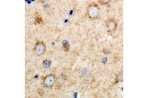 Immunohistochemical analysis of DARS staining in rat brain formalin fixed paraffin embedded tissue section. (DARS antibody)