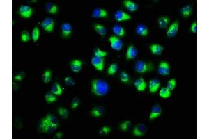 Immunofluorescence staining of Hela cells with ABIN7146972 at 1:333, counter-stained with DAPI. (CTNNA1 antibody  (AA 1-288))