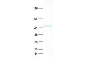 Validation with Western Blot (CIDEC Protein (GST tag,His tag))