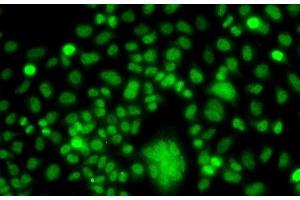 Immunofluorescence analysis of A549 cells using PPAN Polyclonal Antibody (PPAN antibody)