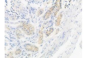 ABIN6256734 and ABIN6267559 at 1/100 staining human normal gastric tissue by IHC-P.