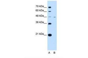 Image no. 1 for anti-Solute Carrier Family 16, Member 1 (Monocarboxylic Acid Transporter 1) (SLC16A1) (AA 201-250) antibody (ABIN320831) (SLC16A1 antibody  (AA 201-250))