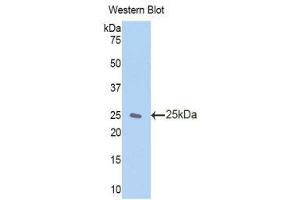 Western Blotting (WB) image for anti-Zinc Finger, AN1-Type Domain 6 (ZFAND6) (AA 19-208) antibody (ABIN1860972) (ZFAND6 antibody  (AA 19-208))