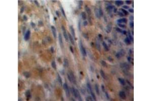 Used in DAB staining on fromalin fixed paraffin-embedded Ovary tissue (Inhibin alpha antibody  (AA 233-366))