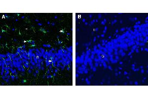 Expression of CD9 in rat hippocampus. (CD9 antibody  (Extracellular))