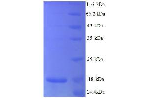 SDS-PAGE (SDS) image for Chemokine (C-C Motif) Ligand 25 (CCL25) (AA 25-144), (partial) protein (His tag) (ABIN5712660)