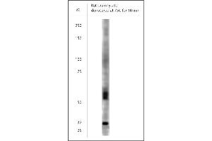 WB on rat brain lysate using Rabbit antibody to VGluT1  at 1:300 dilution. (SLC17A7 antibody)