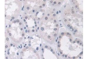 Immunohistochemistry (IHC) image for anti-AHNAK Nucleoprotein (AHNAK) (AA 1-300) antibody (ABIN7436723)