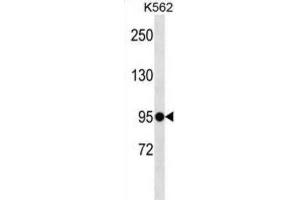 Western Blotting (WB) image for anti-Extracellular Leucine-Rich Repeat and Fibronectin Type III Domain Containing 1 (ELFN1) antibody (ABIN5020065) (ELFN1 antibody)