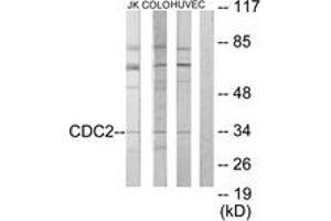 Western blot analysis of extracts from COLO205/HuvEc/Jurkat cells, using CDC2 Antibody. (CDK1 antibody  (AA 101-150))