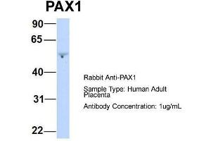 Host:  Rabbit  Target Name:  PAX1  Sample Type:  Human Adult Placenta  Antibody Dilution:  1. (PAX1 antibody  (Middle Region))