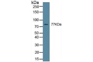 Rabbit Capture antibody from the kit in WB with Positive Control: Hela cell lysate. (Transglutaminase 2 ELISA Kit)