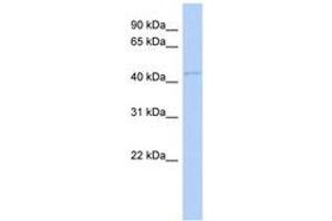 Image no. 1 for anti-Family with Sequence Similarity 98, Member B (FAM98B) (AA 35-84) antibody (ABIN6741368)