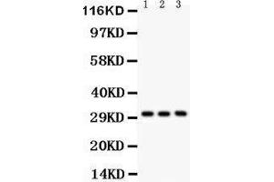 Anti-VDAC Picoband antibody, Western blotting All lanes: Anti VDAC  at 0. (VDAC1 antibody  (Middle Region))