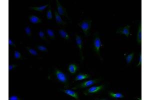 Immunofluorescent analysis of HeLa cells using Diamine acetyltransferase 1 Antibody (1/100 dilution) and AF488-conjugated Goat Anti-Rabbit IgG (H+L) secondary antibody. (SAT1 antibody  (AA 5-171))