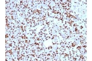 Formalin-fixed, paraffin-embedded human Pancreas stained with SOX9 Mouse Monoclonal Antibody (SOX9/2398). (SOX9 antibody  (AA 393-508))