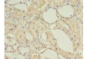 Immunohistochemistry of paraffin-embedded human kidney tissue using ABIN7143242 at dilution of 1:100 (ACOT9 antibody  (AA 1-212))